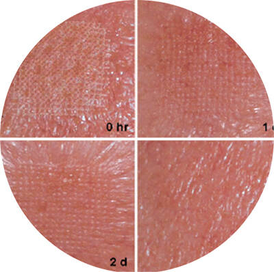 co2 laser beauty machine 