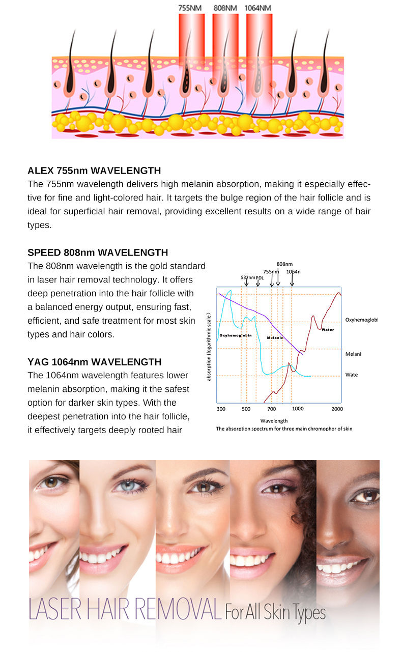 diode laser