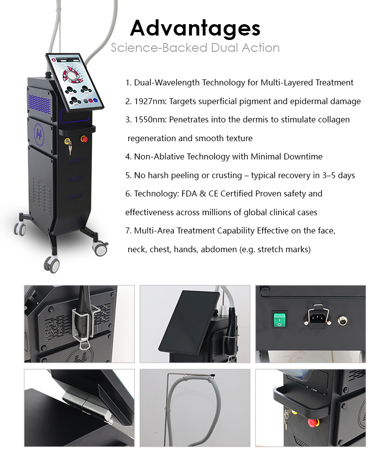 Wrinkle Removal Machine