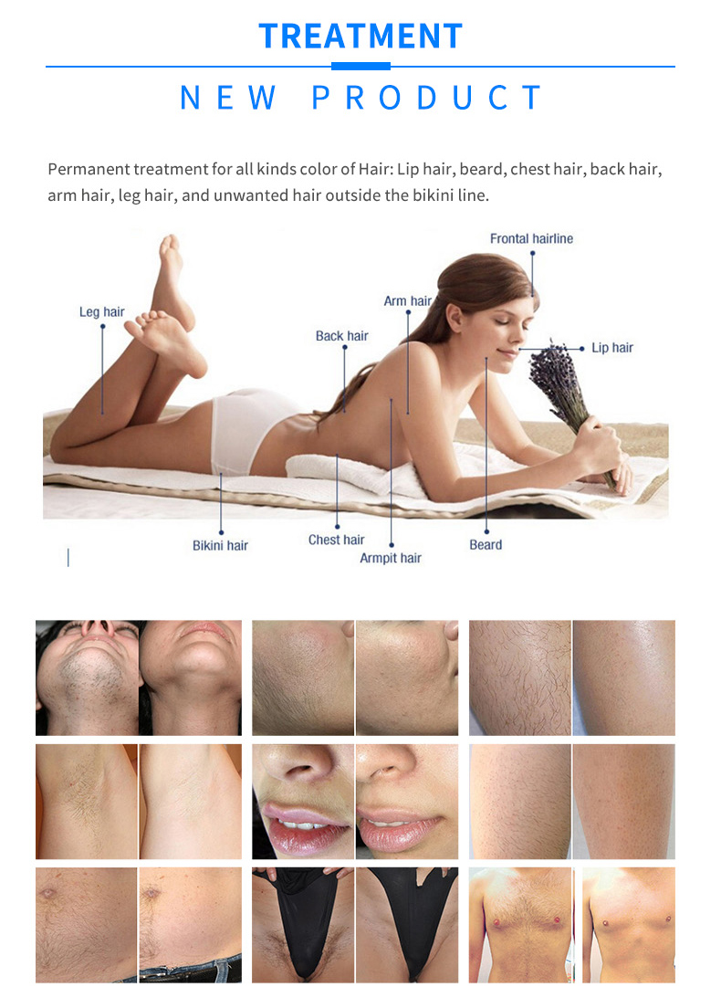 diode laser