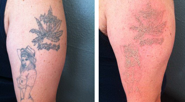 B&A 4