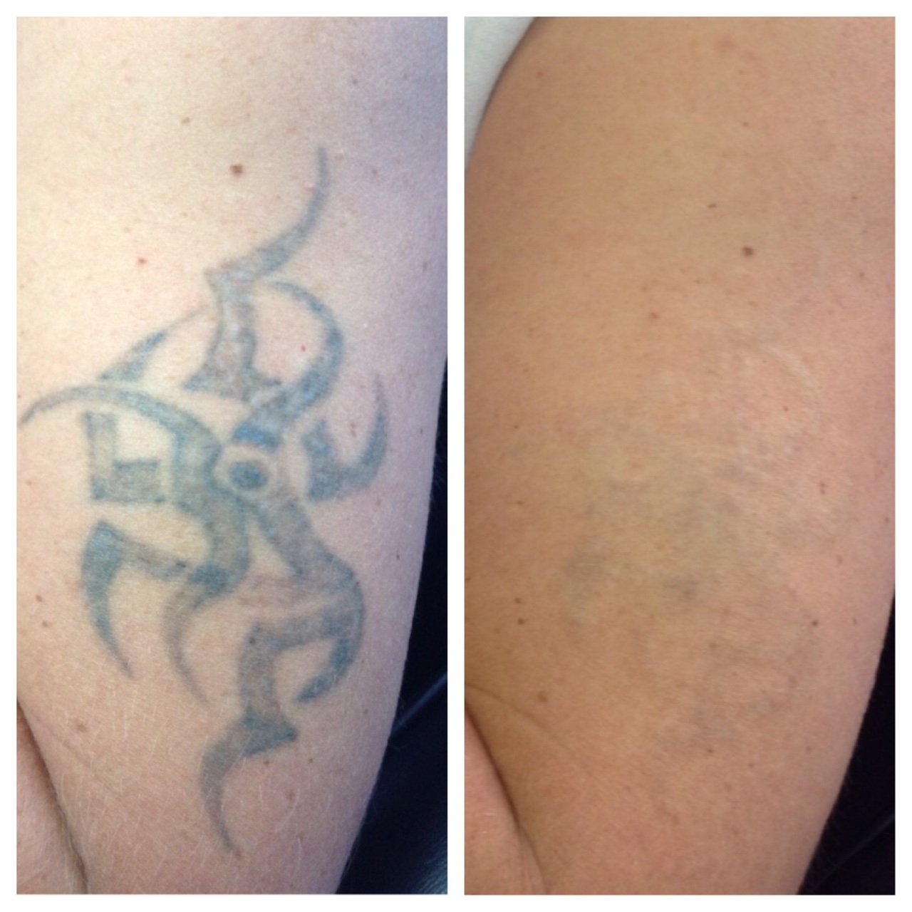 B&A 5