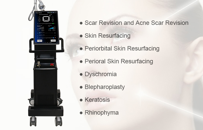 High Power PigmCO2 Fractional Laser Machine