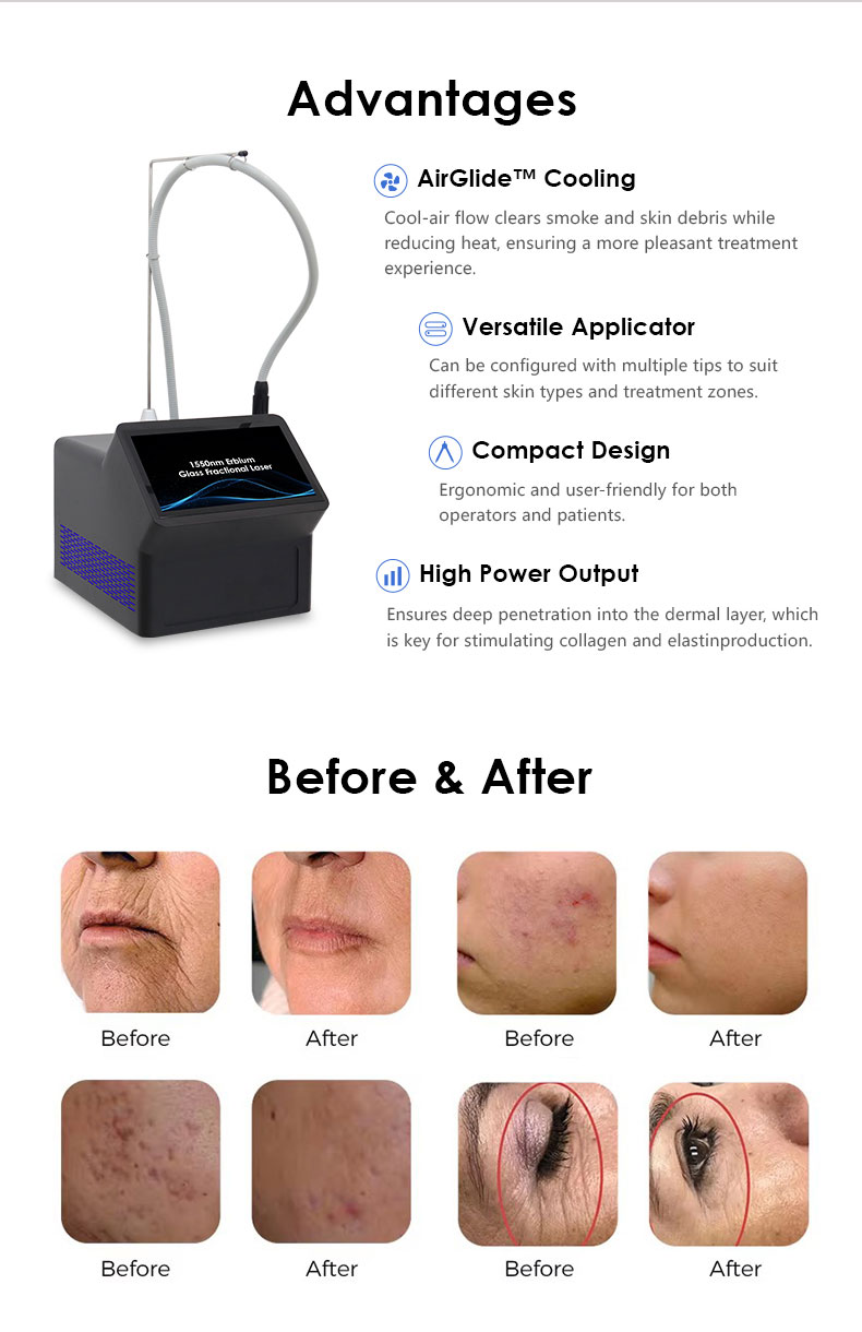 Skin Rejuvenation Machine
