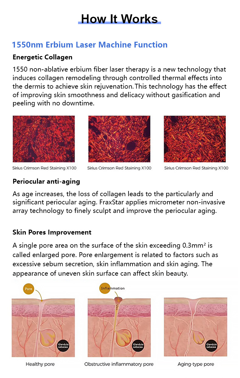 Erbium Glass Laser