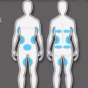 1-IS Coolsculpting(Cryolipolysis) weight loss worth doing?