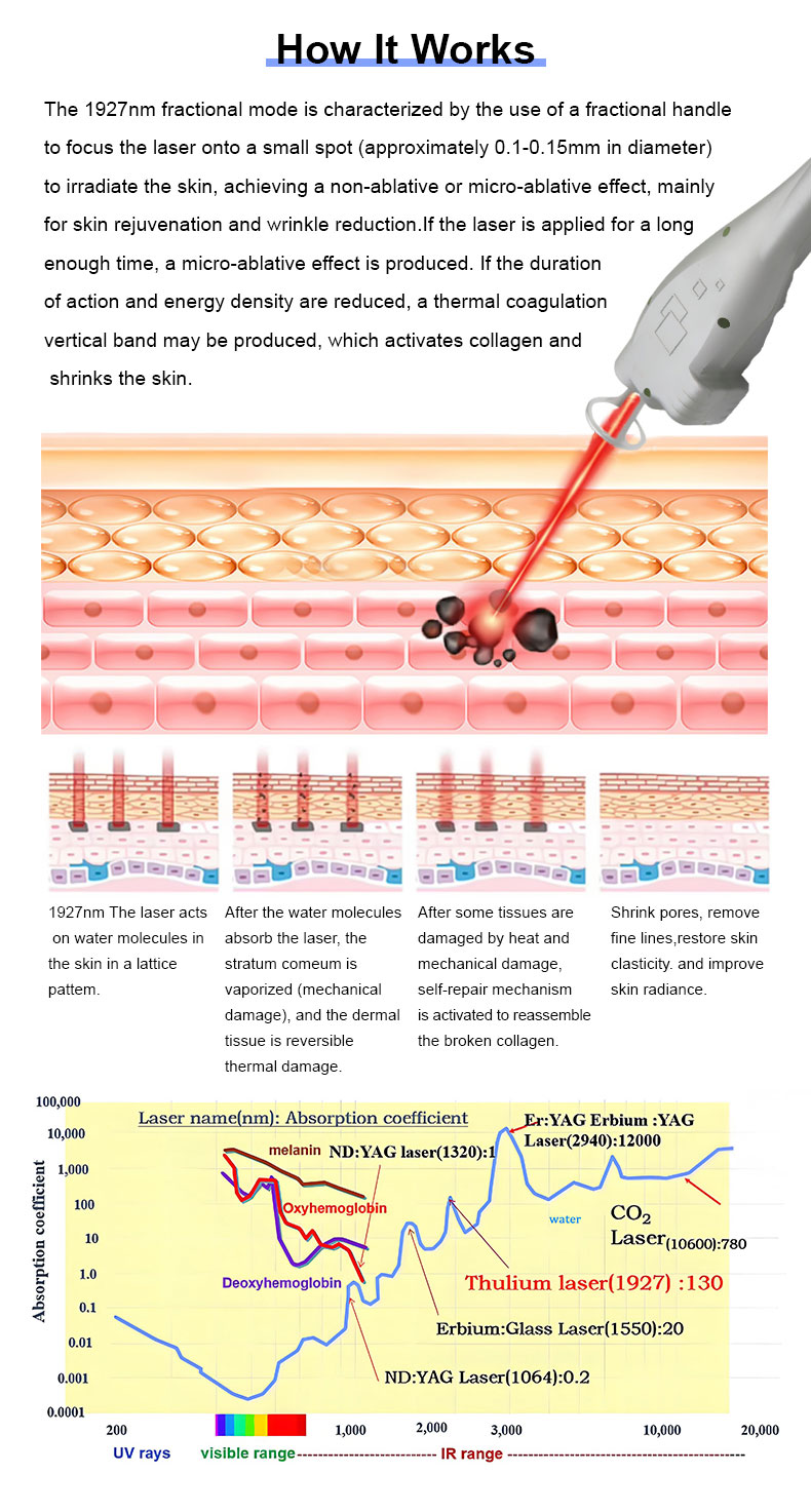 Thulium Laser