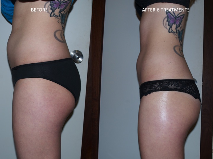 B&A 3