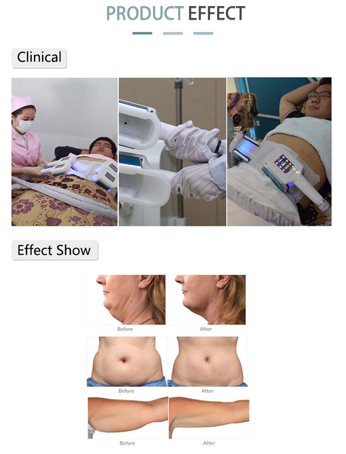 Cryolipolysis Slimming machine (2)