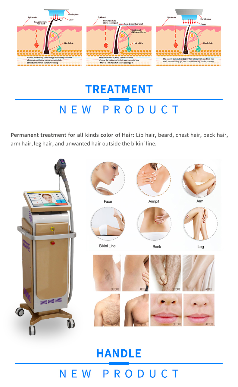 hair removal machine