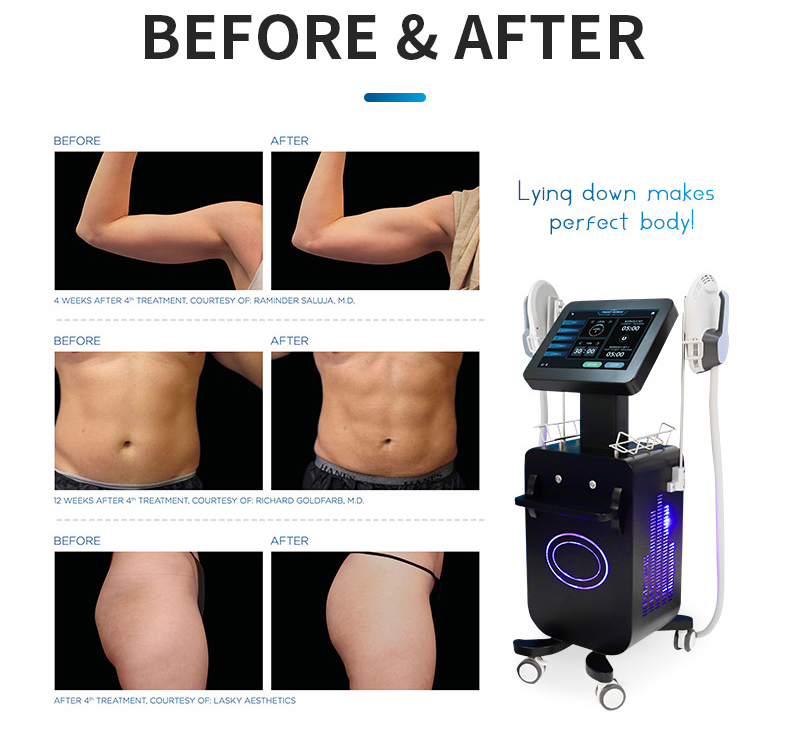 EMS machine