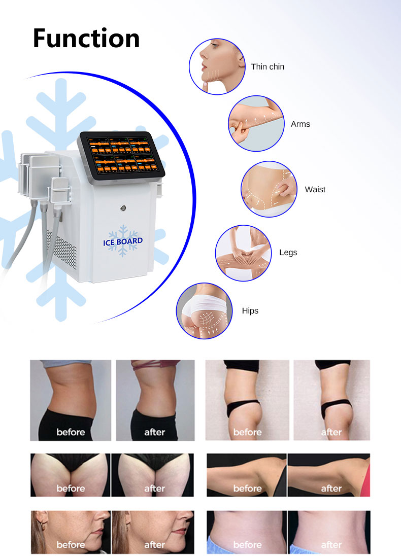 Frozen Board Slimming Machine
