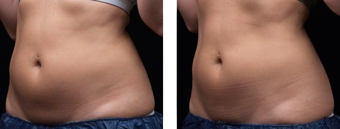 B&A 1