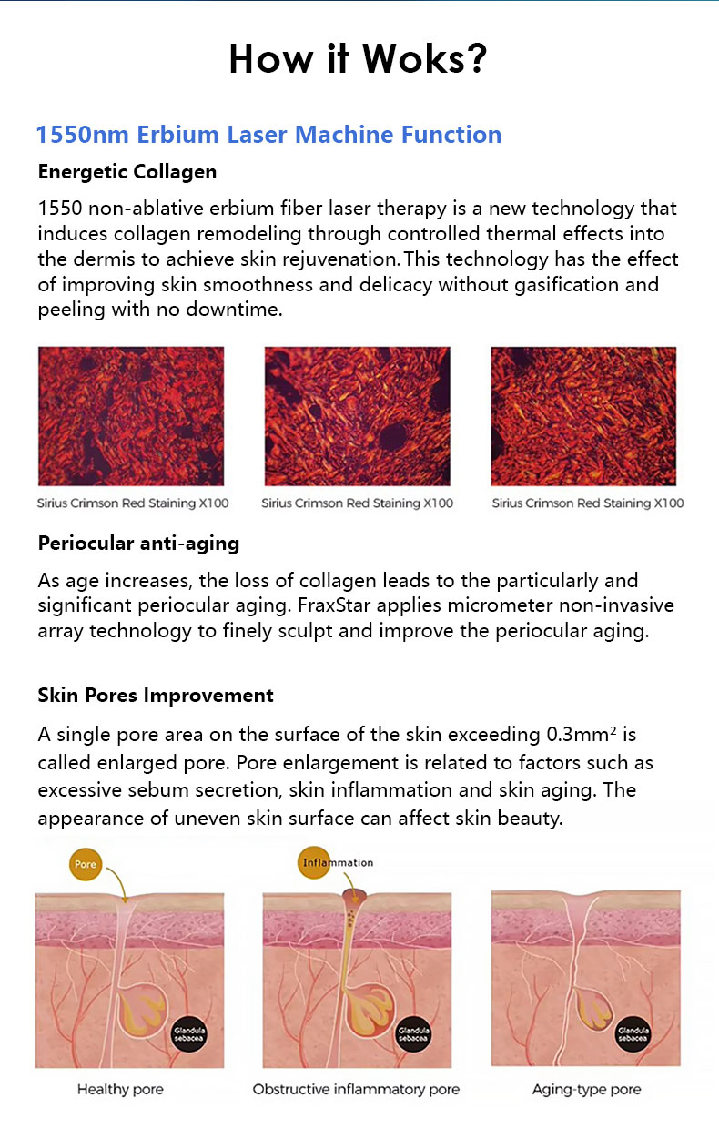 Skin Rejuvenation Machine